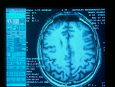Документальный фильм  "BBC: Тайны мозга (Brain Story)" (2000)